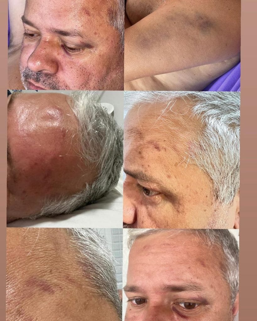 Prefeito de Ceará-Mirim fala pela primeira vez sobre polêmica