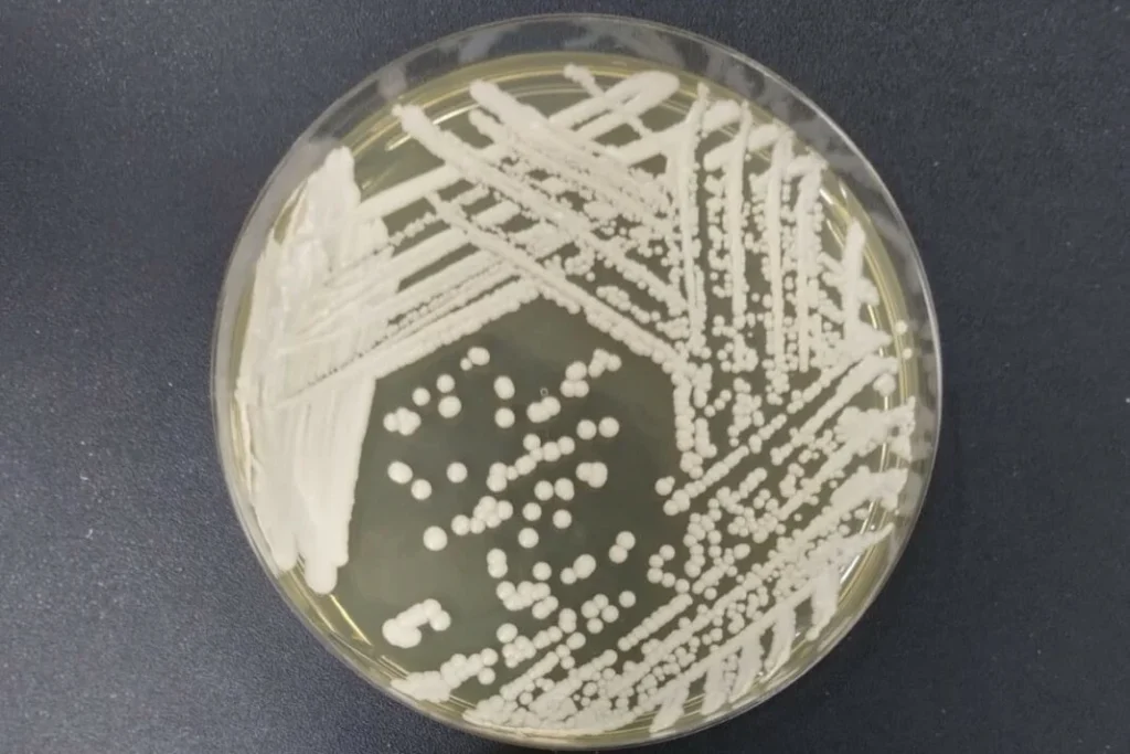 Sesap confirma caso de Candida auris em paciente internado no Hospital da PM, em Natal