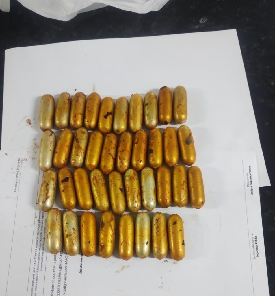 Homem é preso por tráfico após cirurgia retirar 38 cápsulas de cocaína do organismo
